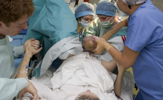 剖腹產手術 (61) 