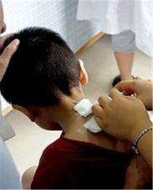 中醫治療小兒慢性支氣管炎