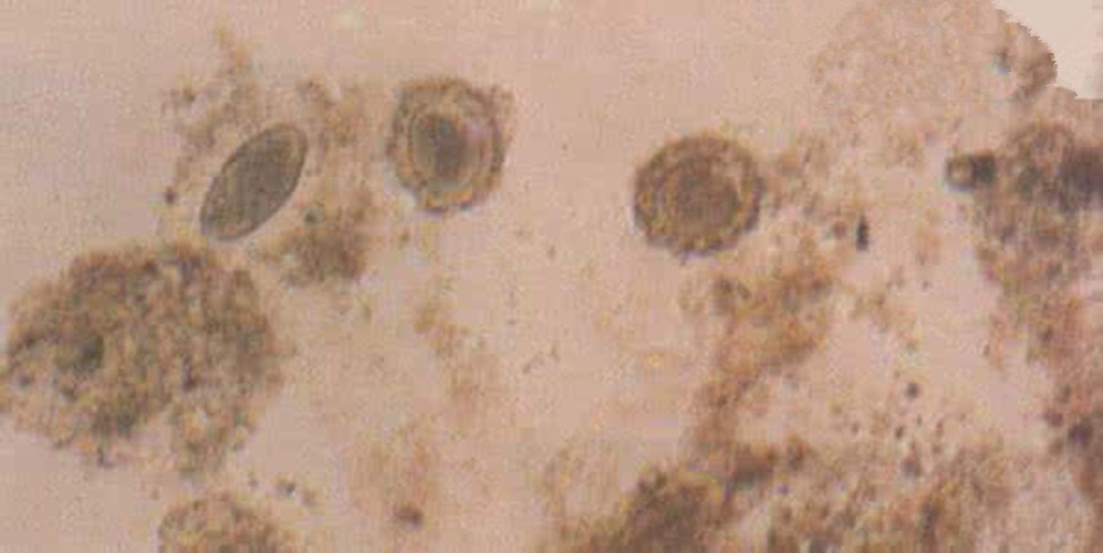 蛔蟲病症狀渾身 