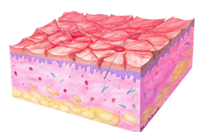 皮膚澱粉樣變 (57) 