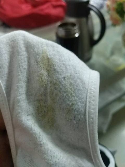 先兆流產分泌物