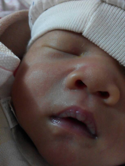 新生兒嘴唇發紫 (40) 