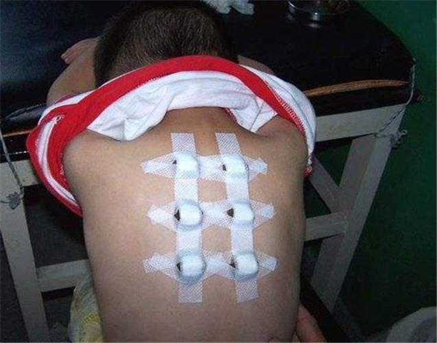 中醫治療慢性支氣管炎