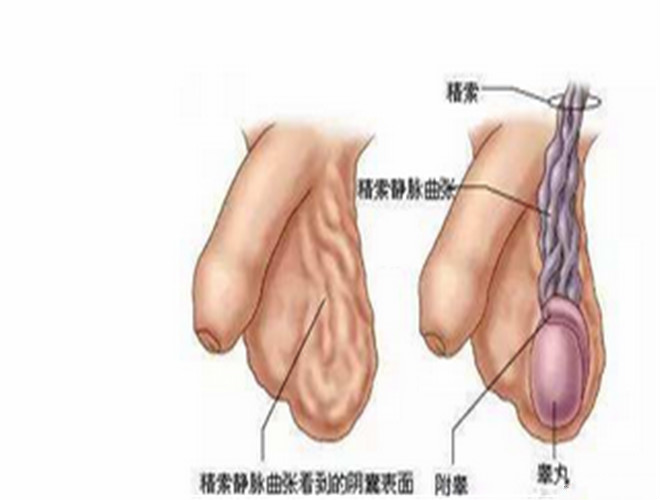 陰囊癢癢是怎麼回事 