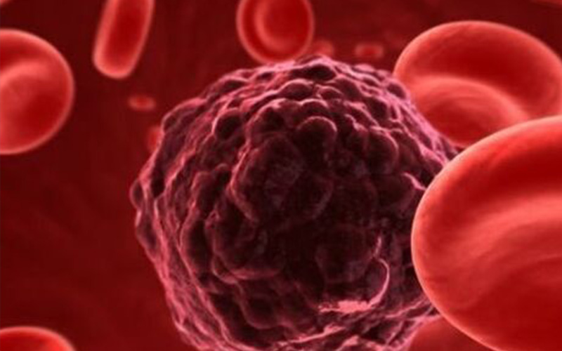 腎上腺腫瘤細胞 