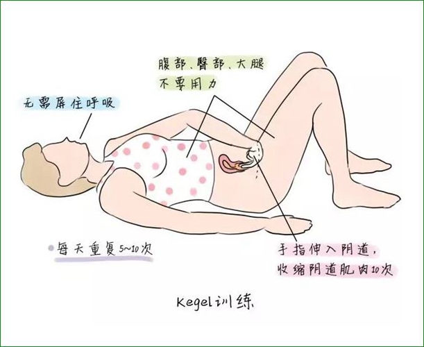 子宮脫垂康復鍛鍊