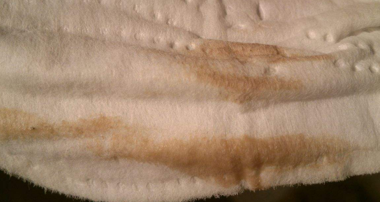 白帶帶有褐色分泌物 (56) 