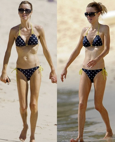 身體消瘦的原因 (82) 