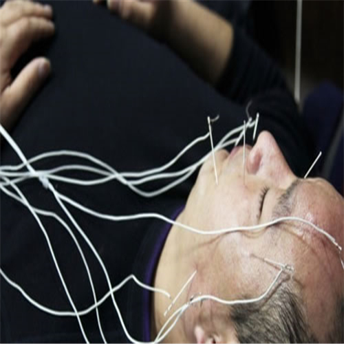 治療面肌痙攣的效果