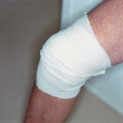 膝蓋半月板損傷症狀 (45) 