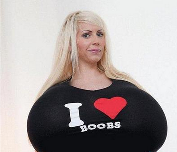 巨乳症有哪些症狀