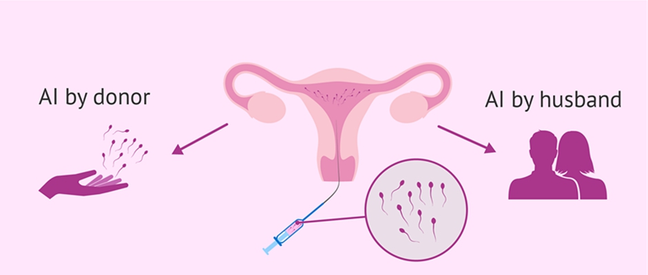 人工受完孕的過程 (43) 