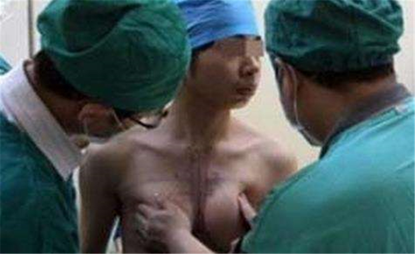 男性假兩性畸形胸部