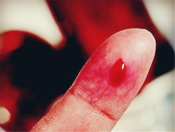 再生障礙性貧血傷口