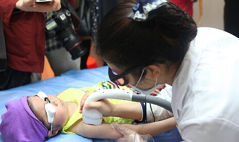 藥物導致的多毛症治療