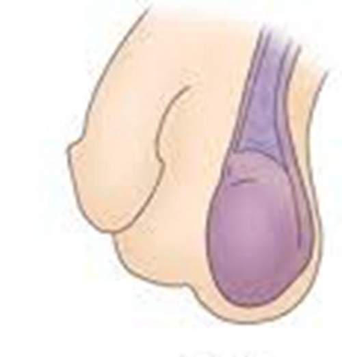 睪丸形狀解析圖的