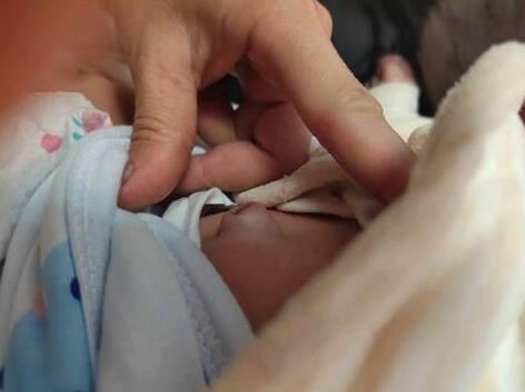 男寶寶疝氣的症狀