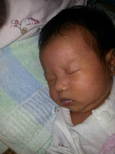 寶寶鵝口瘡 (71) 