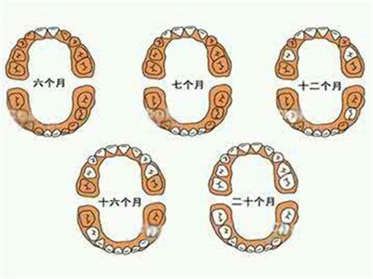 乳牙換牙順序 (34) 