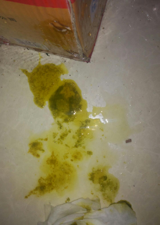 新生兒腹瀉大便