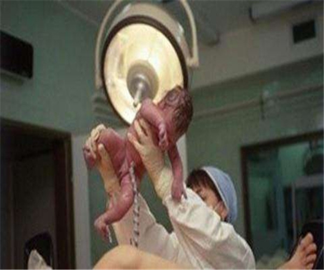 順產視頻全部過程 