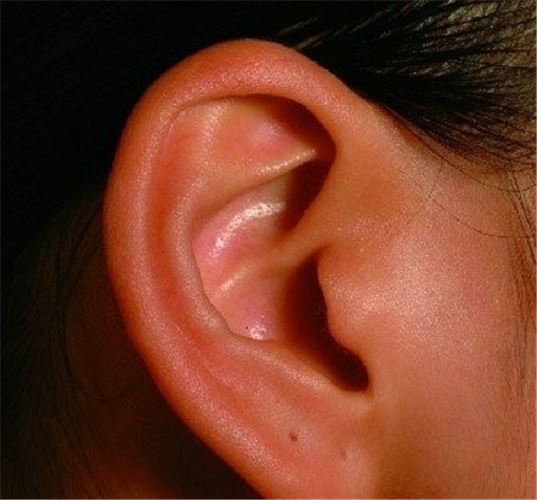 真菌性外耳道炎早期症狀