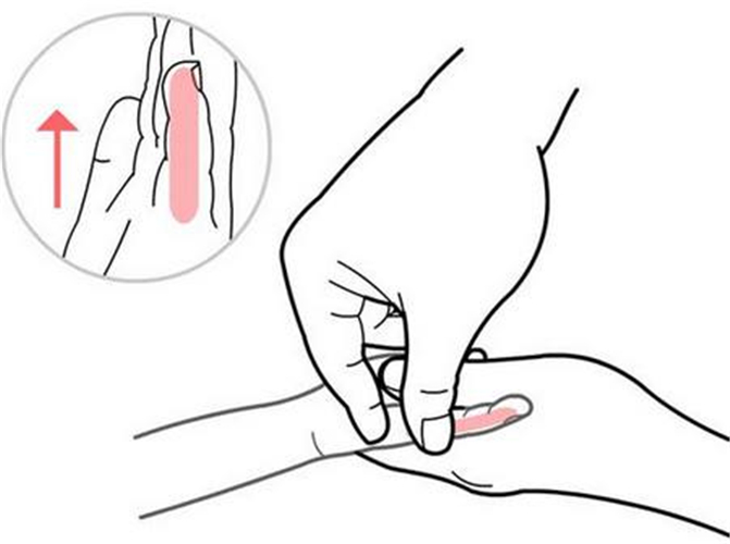 手部推拿治療母乳性腹瀉
