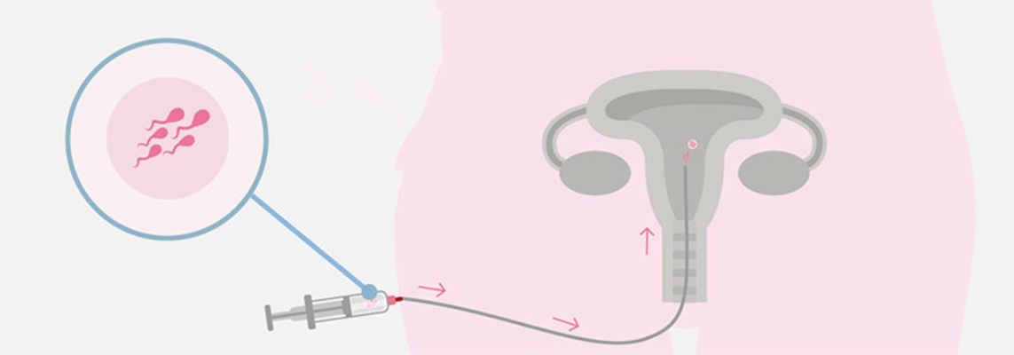 人工受完孕的過程 (4) 