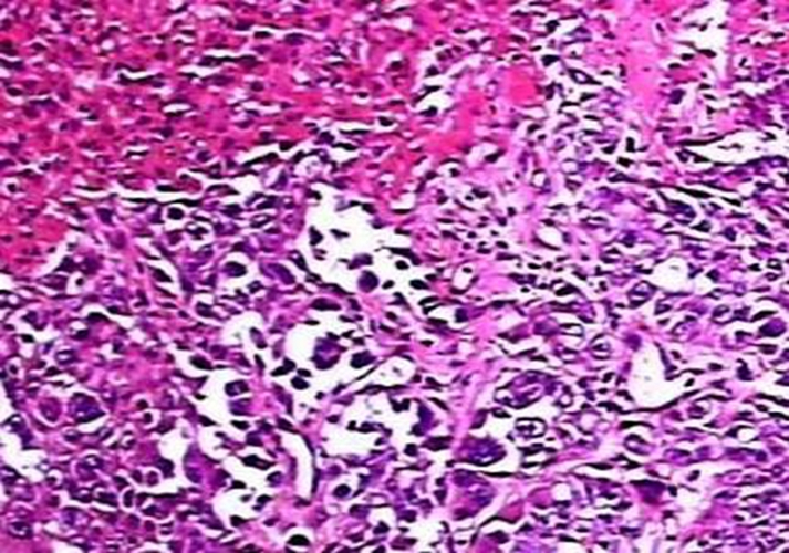 外陰潰瘍細菌細胞