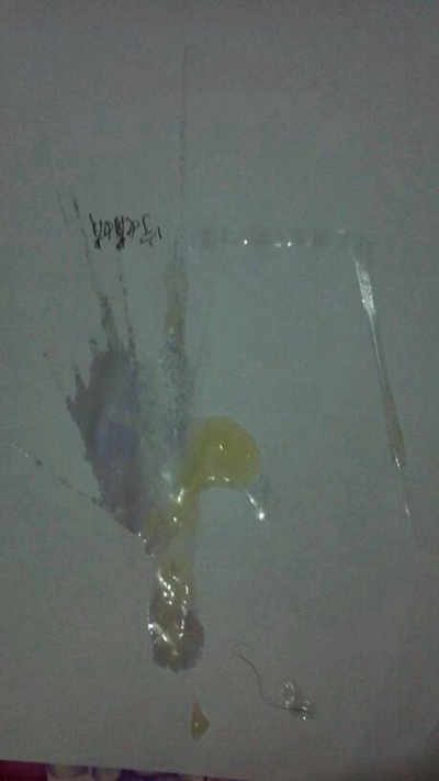 不正常精液液化