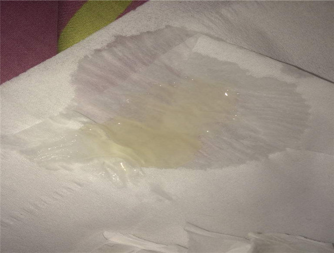 正常精子顏色參考圖 