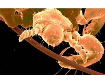 體內有寄生蟲的症狀 (9) 