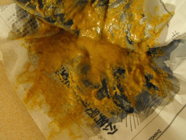 新生兒消化不良大便圖 (50) 