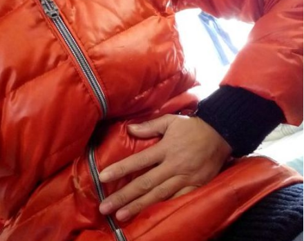 闌尾炎的症狀表現 (66) 