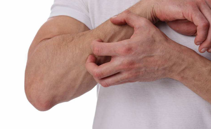 身體蟎蟲過敏症狀