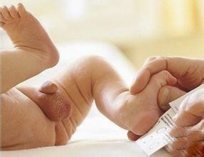 小兒鞘膜積液 (7) 