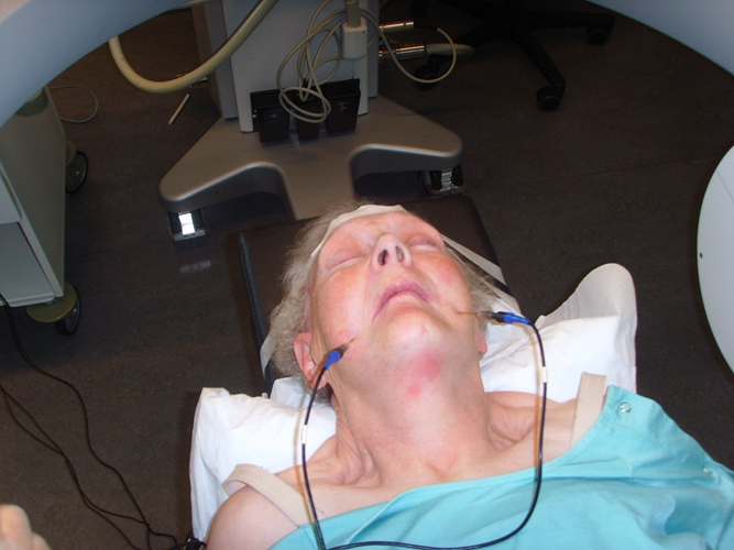 三叉神經痛治療方法