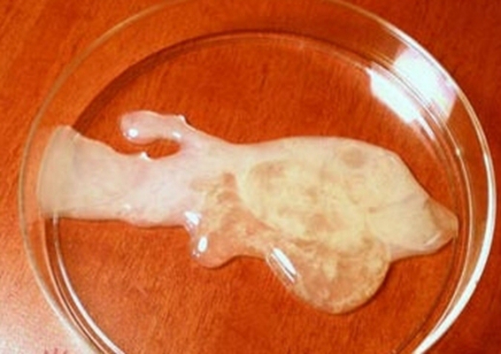 不正常精液液化