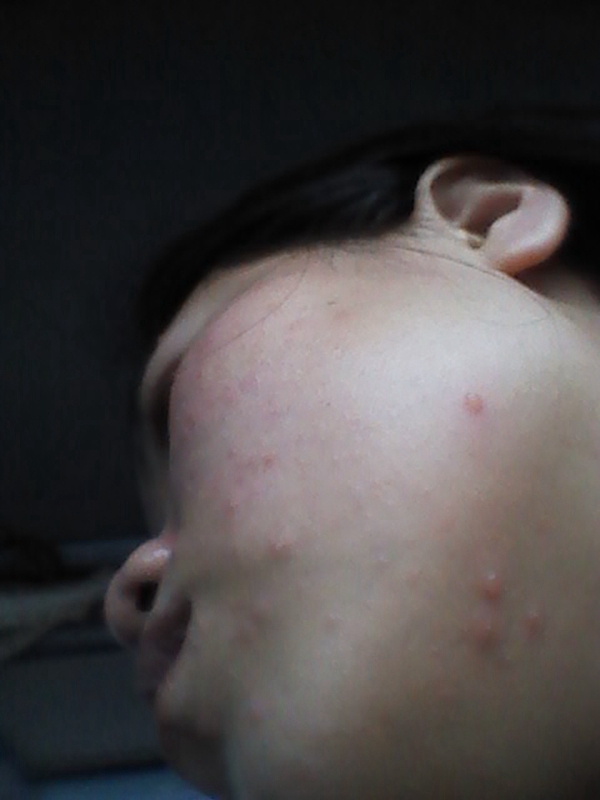 小孩流感怎麼辦圖 