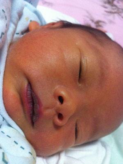 新生兒嘴唇發紫 (50) 