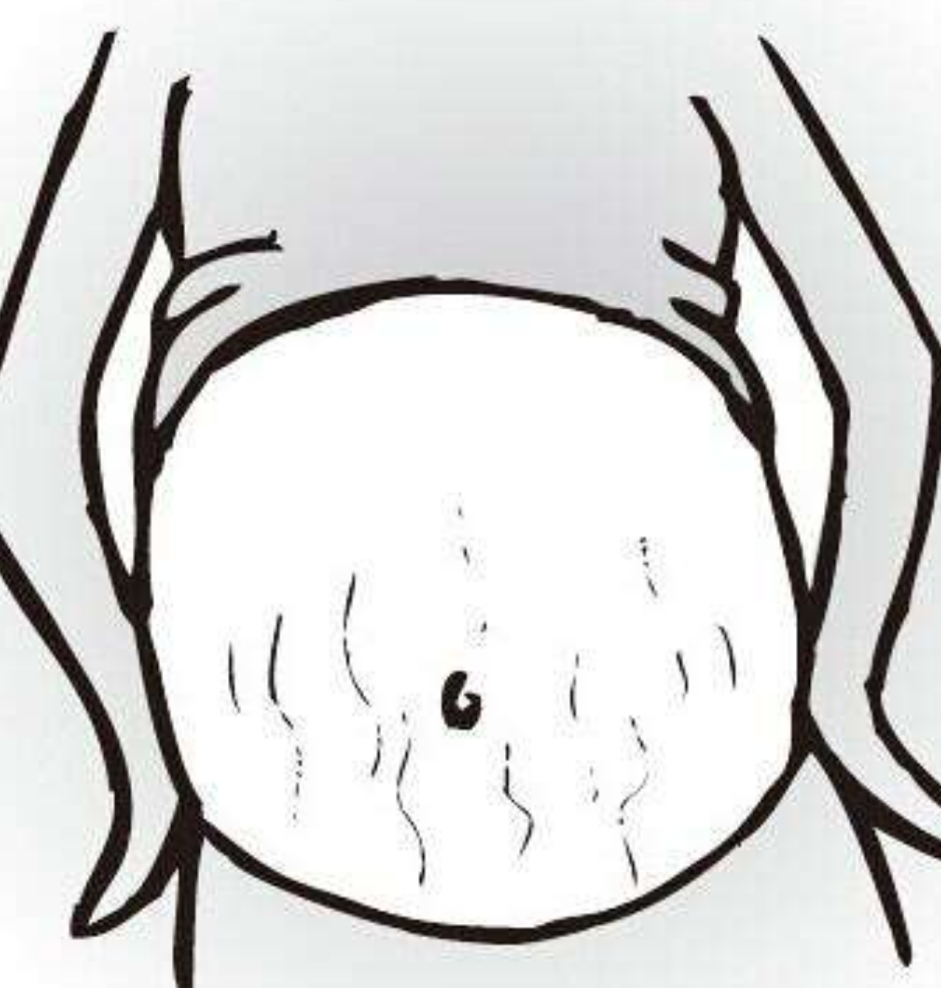 懷孕期妊辰紋漫畫