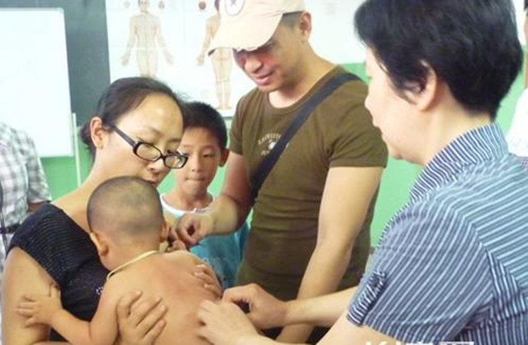 中醫捏脊治療母乳性腹瀉