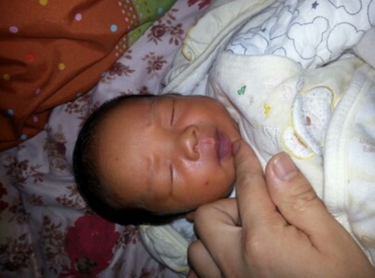 嬰兒嘴唇發紫 (44) 