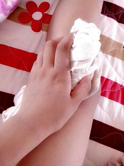 膝蓋半月板損傷症狀 (8) 