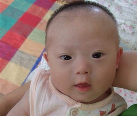 唐氏寶寶 (49) 