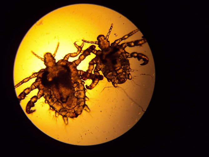 陰蝨檢查的一些