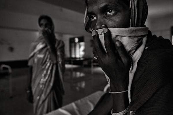 空洞型肺結核能活多久 (47) 