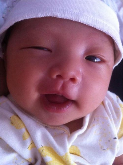 嬰兒嘴唇發紫 (5) 