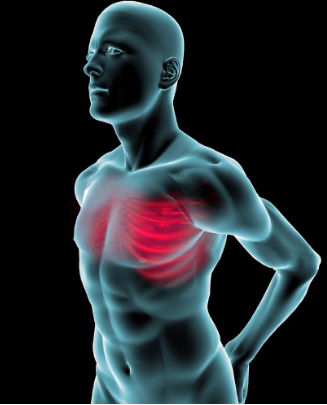 肋間神經炎疼痛部位