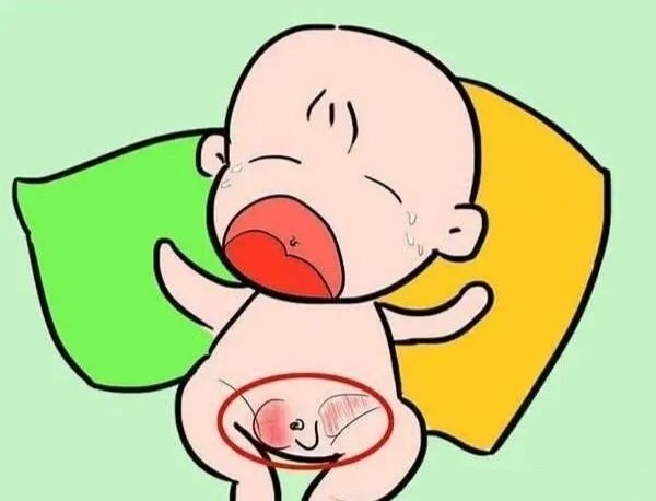 男寶寶疝氣的症狀